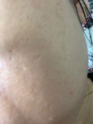 体验后-洛伊科技抗衰护肤中心