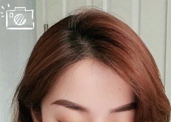 -大麦微针植发丨全国连锁