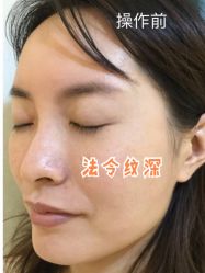 -上海时光整形外科医院