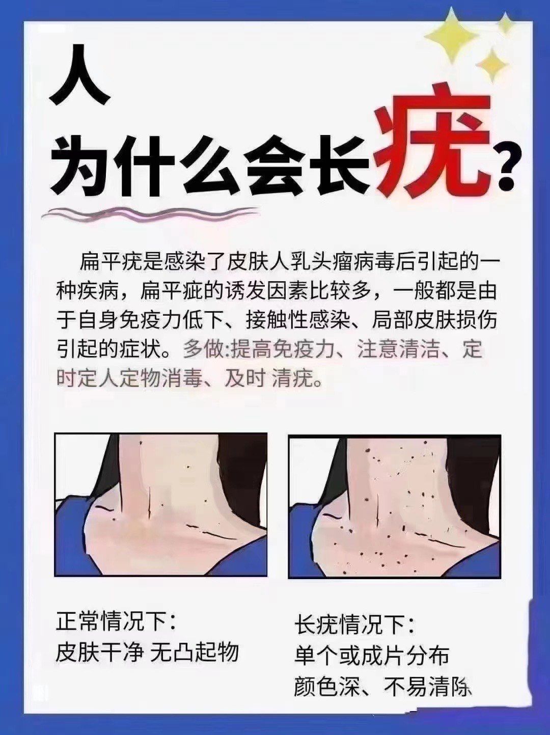 n⑥皮脂腺疣  
⑦传染性软疣
07所有的疣都是一种病毒性皮肤