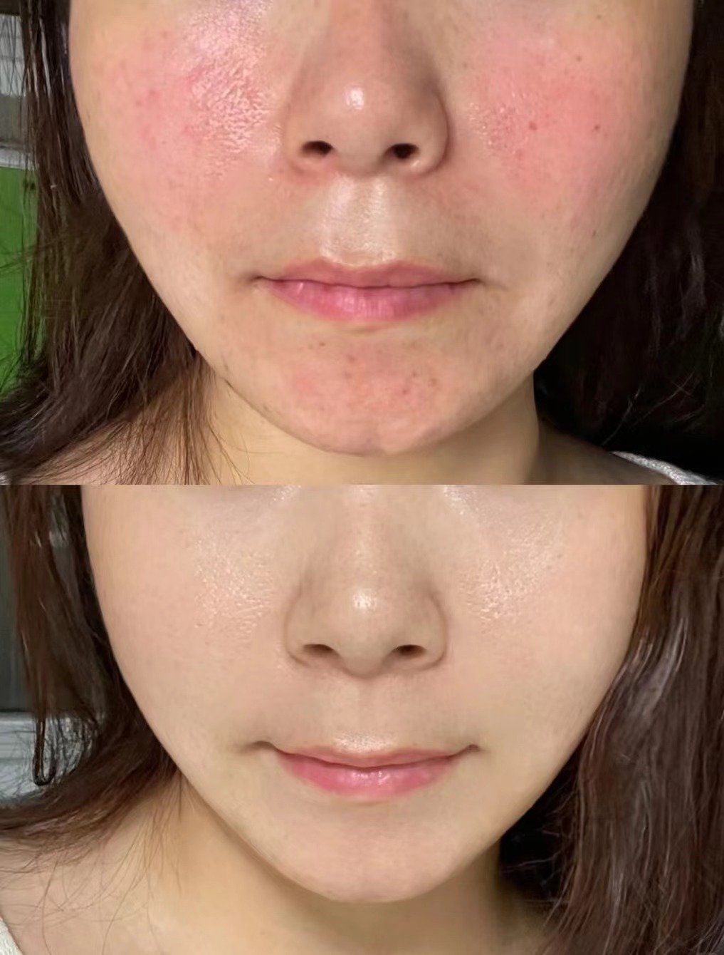 皮肤敏感 角质层薄 k8防晒活氧舒缓