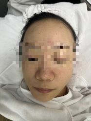-元熙兰积皮肤管理