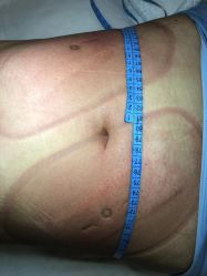 -肥三针腧穴瘦身馆