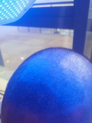 -碧莲盛·不剃发植发