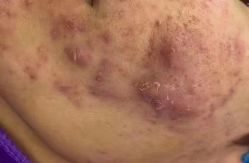 -Cream88颜皮肤管理中心