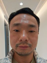 点击看大图 体验后-BR光电保养