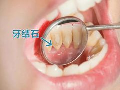 -瑞泰口腔(大宁分院)