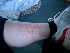 -华夏良子·足道SPA艾灸(龙潭路店)