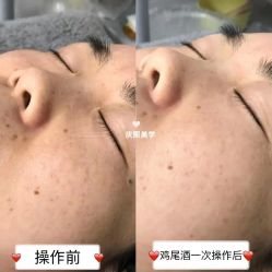 -S庆熙美学皮肤管理