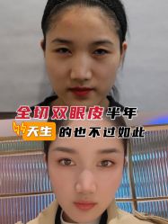 -上海时光整形外科医院