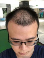 -爱秀造型 T-G