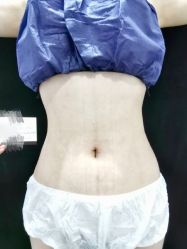 -洁铭新加坡医美