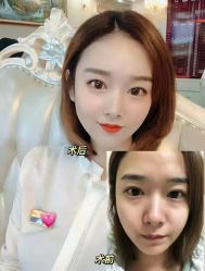 -天津健丽·去眼袋医疗美容机构