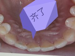 -上海仁爱医院口腔科 · 种植