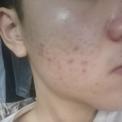 -沈阳亿美医疗美容