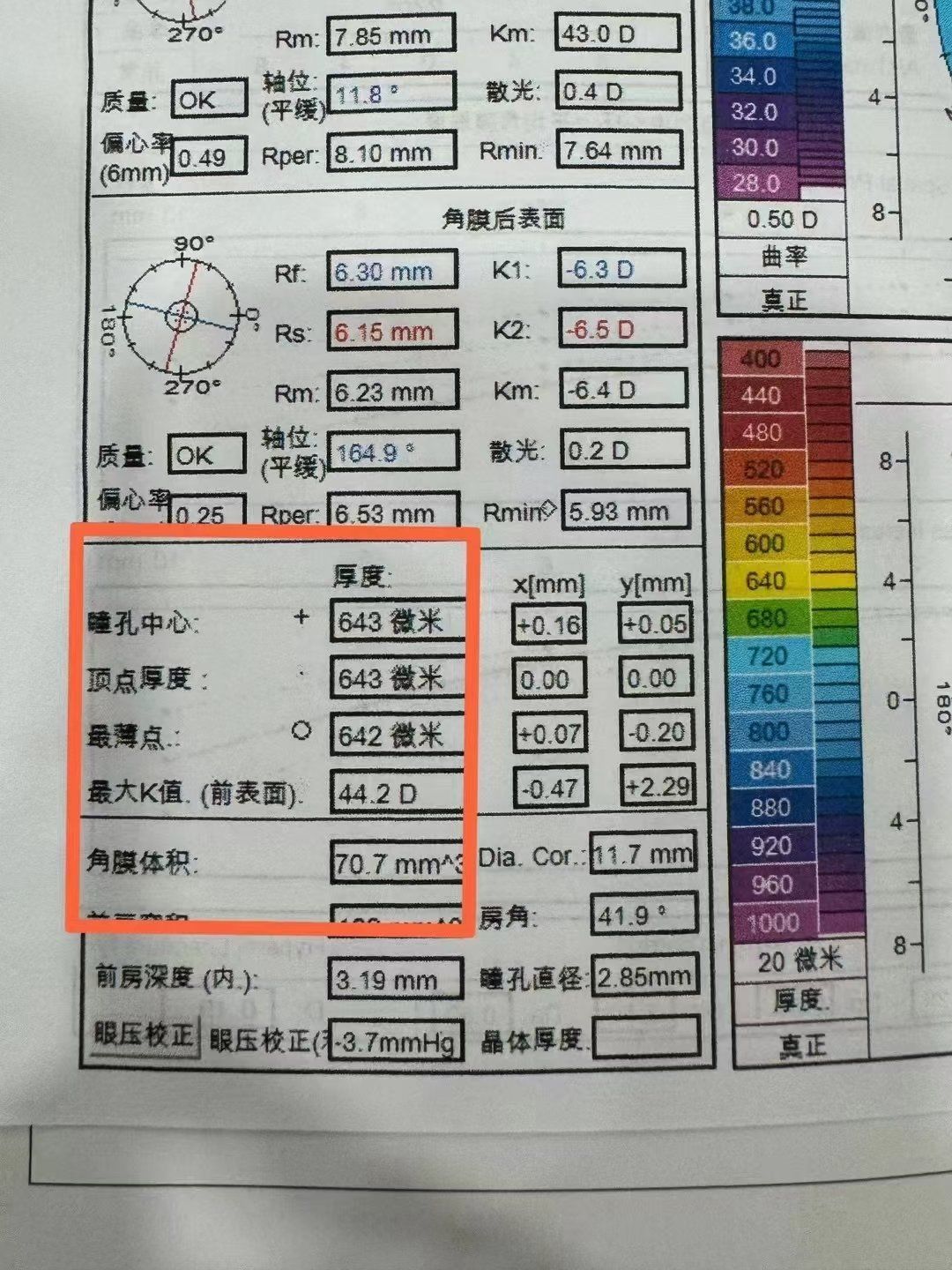 术前检查角膜厚度