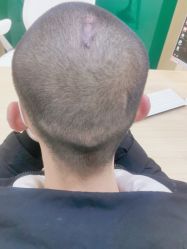 -雍禾植发全国连锁