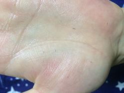 -咪咪比基尼脱毛专业店