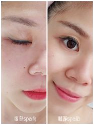 -美壹生诊所皮肤管理中心·海菲秀&Legacy美白舱