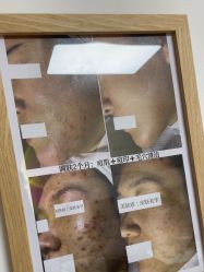 -美肤盾祛痘·问题肌头疗管理中心