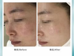 -雅世·合金公寓