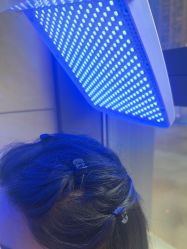 -碧莲盛·不剃发植发