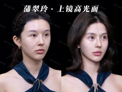 -深圳艺星医疗美容医院