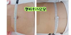 -Lily纤美·科技减脂中心