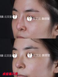 -北京米扬丽格医疗美容·联合丽格鼻整形中心