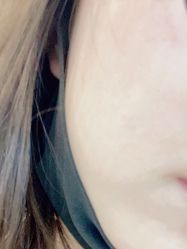 -丽美妍医疗美容·皮秒·立体分层抗衰