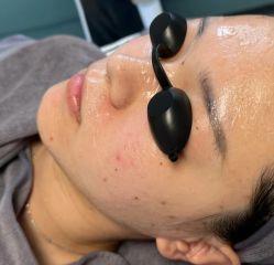 -天津健丽·去眼袋医疗美容机构