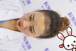 点击看大图 -大麦微针植发丨全国连锁