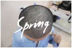 -大麦微针植发全国连锁