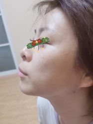 体验后-北京京通医院医疗美容