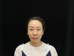 体验前-西安伊美尔医疗美容医院
