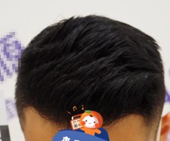 -大麦微针植发全国连锁