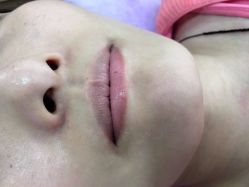 原来唇色-西施无菌半永久纹绣眉眼影唇轻增发纹发际线