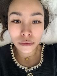 体验前-Yestar艺星医疗美容医院