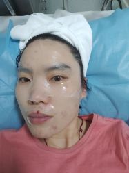 体验后-北京丽星翼美医疗美容