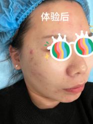 体验前-上海时光整形外科医院