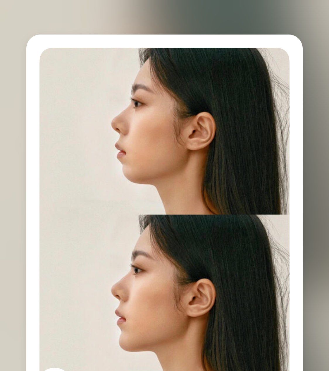 侧脸好不好看关键在下巴