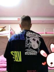 点击看大图 -大麦微针植发丨全国连锁