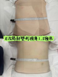 -Lily纤美·科技减脂中心