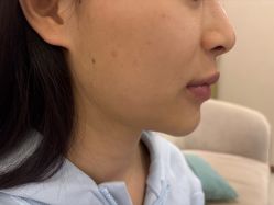 -长沙雅美医疗美容医院