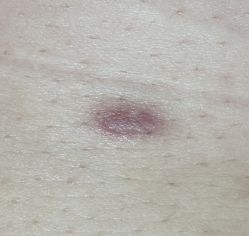 -西安现代妇产医院医疗美容