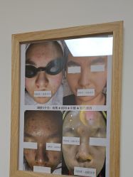 -美肤盾祛痘·问题肌头疗管理中心