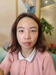 -素美医疗美容·西南眼鼻整形·修复基地