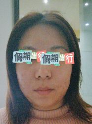 体验前-Yestar艺星医疗美容医院