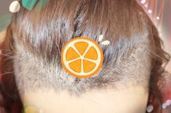 -大麦微针植发全国连锁