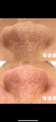 点击看大图 -SKIN79皮肤管理中心
